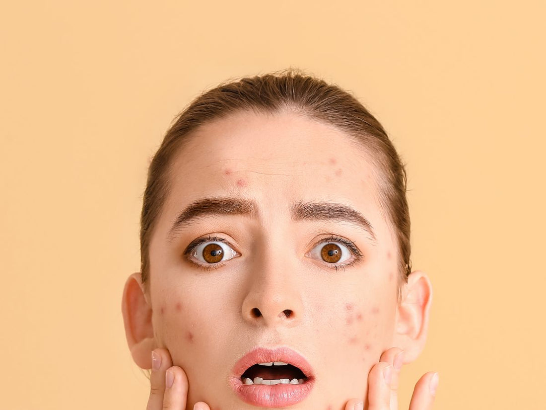what does stress do to skin